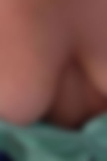 Louise P"Braless Beauty"